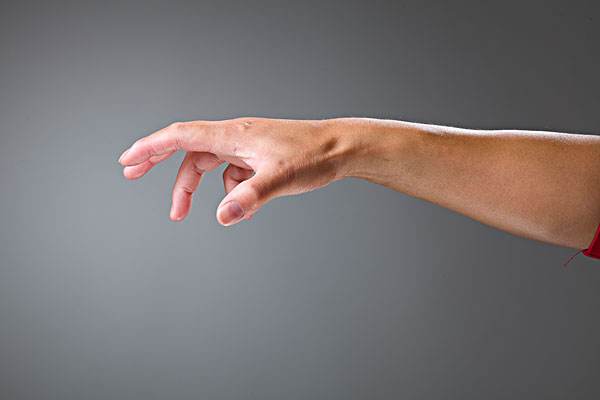 掰手指為什么會(huì)變響 長(zhǎng)掰手指會(huì)導(dǎo)致關(guān)節(jié)炎嗎 掰手指為什么會(huì)變響 長(zhǎng)掰手指會(huì)導(dǎo)致關(guān)節(jié)炎嗎