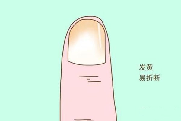 如何增長甲床 如何把甲床養(yǎng)得好看 如何增長甲床 如何把甲床養(yǎng)得好看