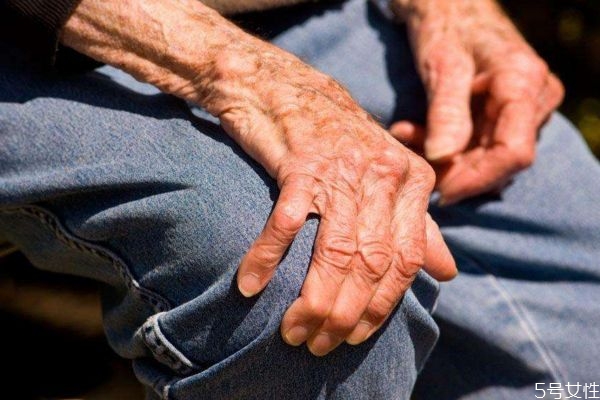 帕金森的高發(fā)人群有哪些呢 如何預(yù)防帕金森呢 帕金森的高發(fā)人群有哪些呢 如何預(yù)防帕金森呢