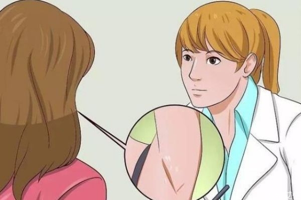 狐臭造成的原因有什么呢 如何預(yù)防狐臭呢 狐臭造成的原因有什么呢 如何預(yù)防狐臭呢