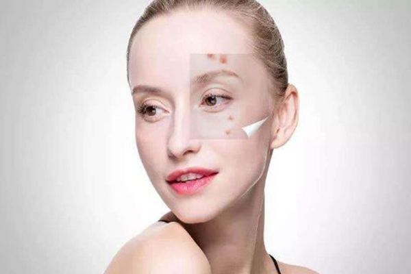 撲爾敏可以治療皮膚病嗎 撲爾敏有哪些副作用 撲爾敏可以治療皮膚病嗎 撲爾敏有哪些副作用