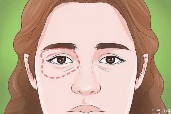 黑眼圈是怎么產(chǎn)生的呢 天生的黑眼圈是怎么造成的呢 黑眼圈是怎么產(chǎn)生的呢 天生的黑眼圈是怎么造成的呢