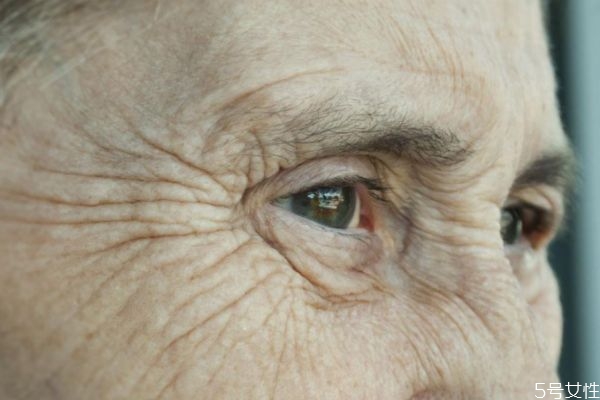 預防皺紋的方法有什么呢 如何能有效預防皺紋呢