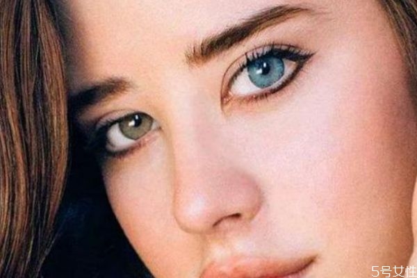 什么是瞳孔異色癥呢 瞳孔異色癥有什么危害嗎 什么是瞳孔異色癥呢 瞳孔異色癥有什么危害嗎