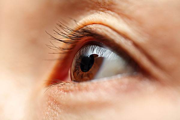 沙眼會不會傳染 沙眼的治療方法有哪些 沙眼會不會傳染 沙眼的治療方法有哪些