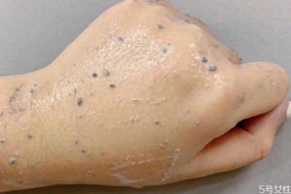 去角質(zhì)慕斯搓出來的是什么 慕斯去角質(zhì)都是假的嗎 去角質(zhì)慕斯搓出來的是什么 慕斯去角質(zhì)都是假的嗎