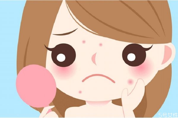 去痘印的方法有什么呢 如何去痘印呢 去痘印的方法有什么呢 如何去痘印呢