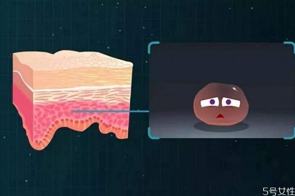 角質層比較厚會怎么樣呢 角質層薄厚有什么區(qū)別呢 角質層比較厚會怎么樣呢 角質層薄厚有什么區(qū)別呢