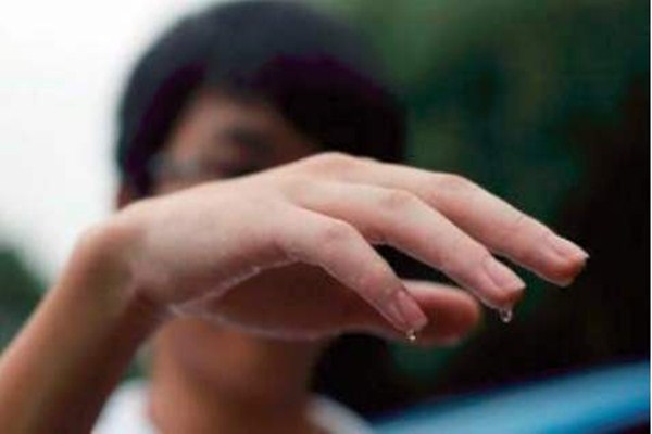 多汗癥是什么 多汗癥出汗程度怎么分級(jí)的 多汗癥是什么 多汗癥出汗程度怎么分級(jí)的