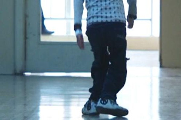 為什么會導(dǎo)致佝僂病 佝僂病前期癥狀有哪些 為什么會導(dǎo)致佝僂病 佝僂病前期癥狀有哪些