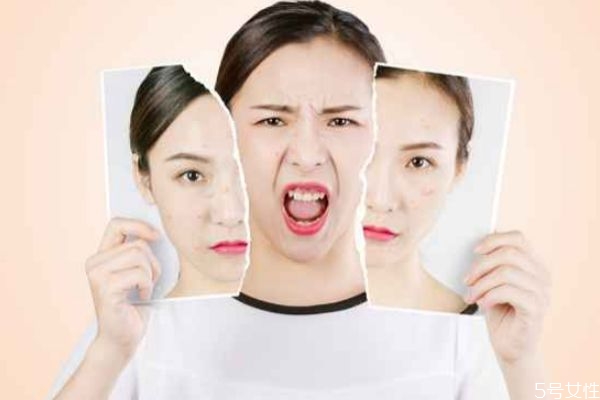 冬天卡粉嚴重怎么辦 化妝卡粉起皮解決小妙招 冬天卡粉嚴重怎么辦 化妝卡粉起皮解決小妙招