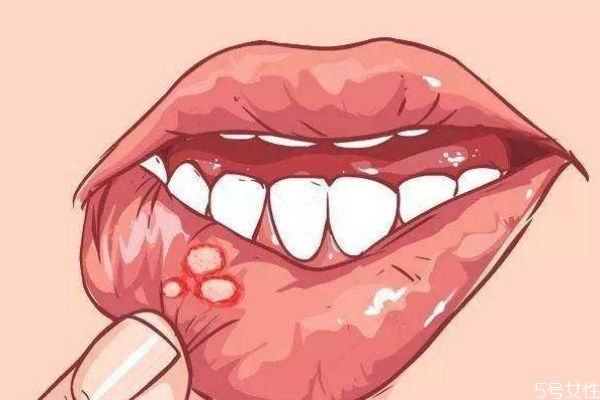 什么是小兒口腔潰瘍呢 小兒口腔潰瘍有什么危害呢 什么是小兒口腔潰瘍呢 小兒口腔潰瘍有什么危害呢