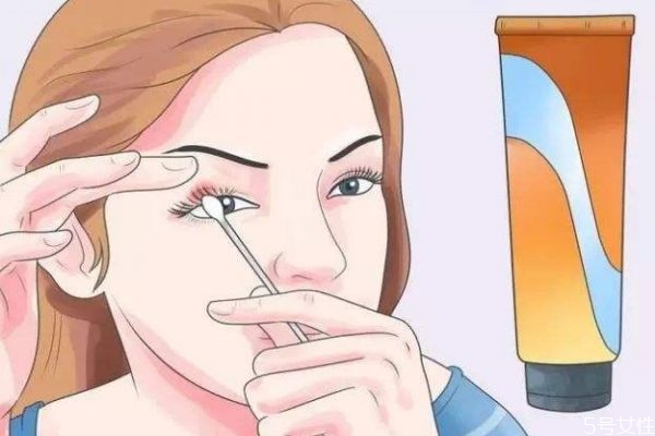 什么是麥粒腫 麥粒腫有什么危害呢 什么是麥粒腫 麥粒腫有什么危害呢