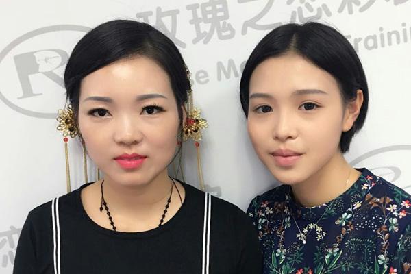 上瞼松弛變美術(shù)是什么 上瞼松弛變美術(shù)術(shù)前要注意什么 上瞼松弛變美術(shù)是什么 上瞼松弛變美術(shù)術(shù)前要注意什么