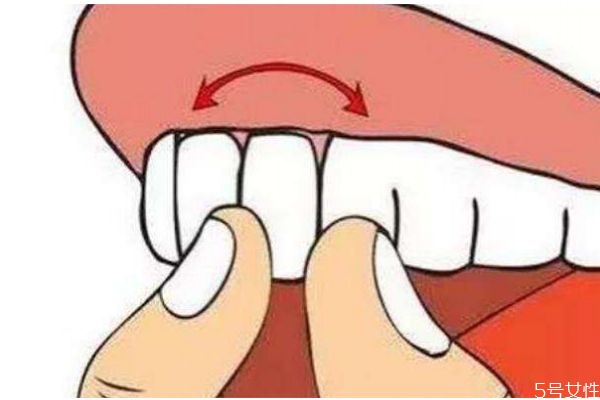 牙齒松動比較疼怎么辦呢 牙齒松動需要拔牙嗎 牙齒松動比較疼怎么辦呢 牙齒松動需要拔牙嗎