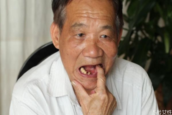 牙齒松動可以吃冰糖葫蘆嗎 牙齒松動不能吃什么呢 牙齒松動可以吃冰糖葫蘆嗎 牙齒松動不能吃什么呢