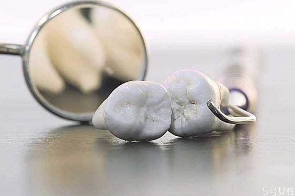 年輕人牙齒松動應該怎么辦呢 年輕人牙齒松動應該怎么辦呢