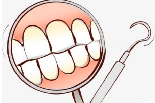 年輕人牙齒松動(dòng)應(yīng)該怎么辦呢 年輕人牙齒松動(dòng)應(yīng)該怎么辦呢