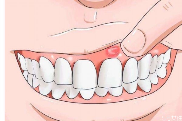 牙齦紅腫是為什么呢 造成牙齦紅腫的原因是什么呢 牙齦紅腫是為什么呢 造成牙齦紅腫的原因是什么呢