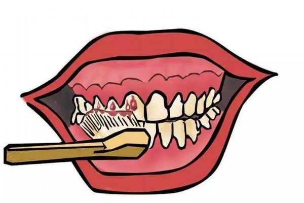 牙齦紅腫是為什么呢 造成牙齦紅腫的原因是什么呢 牙齦紅腫是為什么呢 造成牙齦紅腫的原因是什么呢