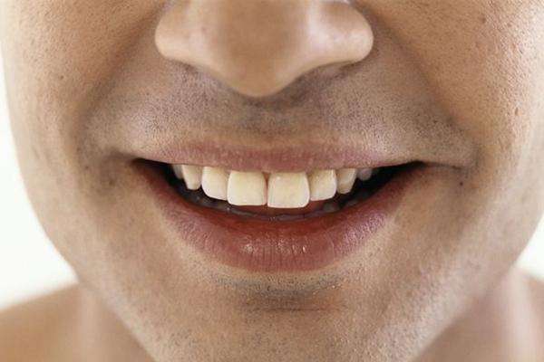 嘴唇發(fā)紫是什么原因 嘴唇發(fā)紫怎么辦 嘴唇發(fā)紫是什么原因 嘴唇發(fā)紫怎么辦