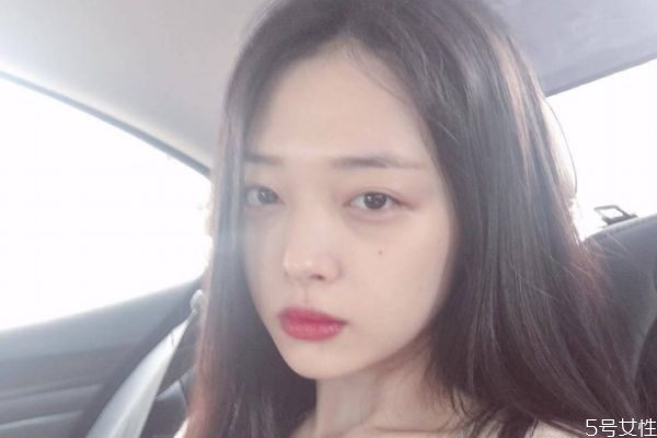 下巴打了玻尿酸有硬塊怎么回事 玻尿酸打下巴會硬幾天 下巴打了玻尿酸有硬塊怎么回事 玻尿酸打下巴會硬幾天