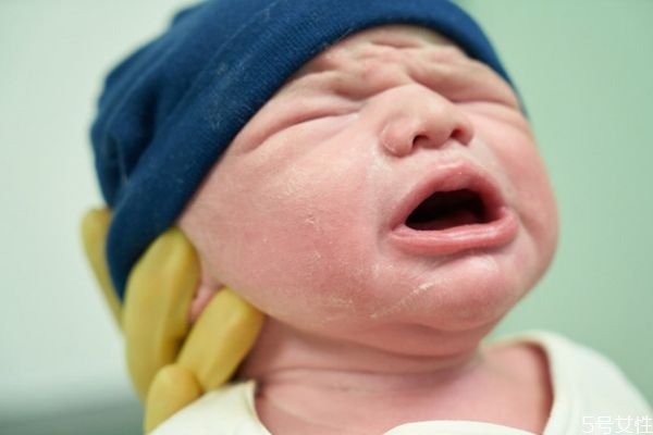 胎毒是什么原因?qū)е碌?去胎毒的最佳時(shí)間 胎毒是什么原因?qū)е碌?去胎毒的最佳時(shí)間