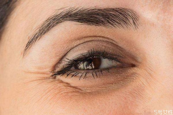 眼部細(xì)紋造成原因有什么呢 為什么會出現(xiàn)眼部細(xì)紋呢 眼部細(xì)紋造成原因有什么呢 為什么會出現(xiàn)眼部細(xì)紋呢