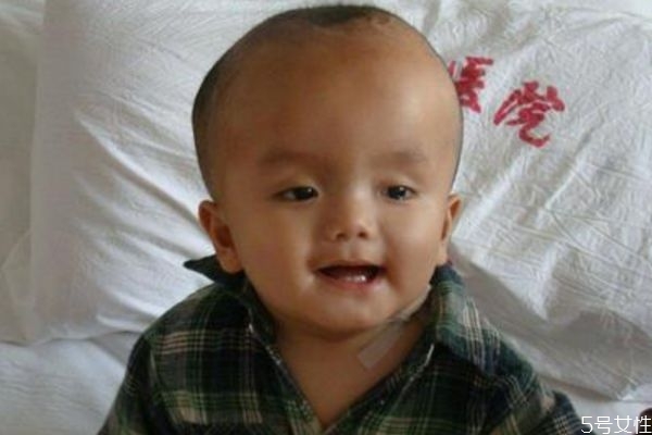 造成腦積水的原因有什么呢 為什么會得腦積水呢