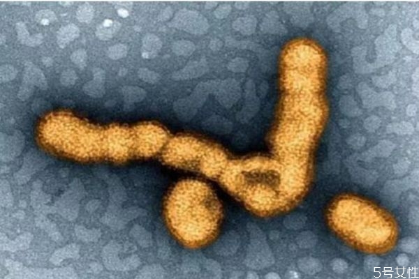 天花是一種什么疾病呢 得天花的癥狀有什么呢 天花是一種什么疾病呢 得天花的癥狀有什么呢