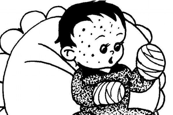 天花是怎么造成的呢 造成天花的原因有什么呢 天花是怎么造成的呢 造成天花的原因有什么呢