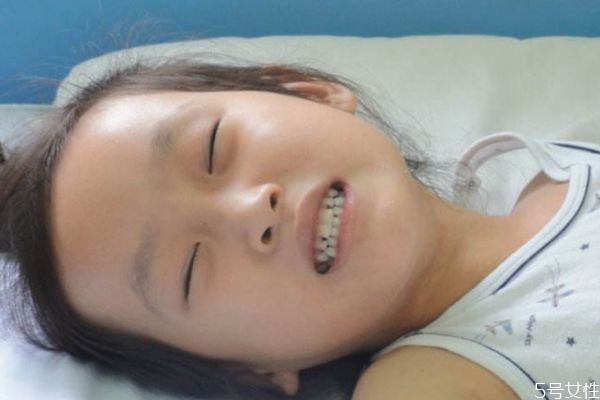 什么是猩紅熱呢 猩紅熱有什么癥狀呢 什么是猩紅熱呢 猩紅熱有什么癥狀呢