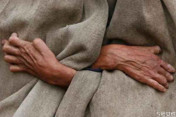 什么是麻風病呢 麻風病有實名癥狀呢