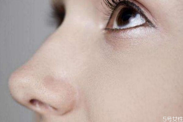 什么是鼻翼縮小手術(shù)呢 鼻翼縮小手術(shù)后有什么注意的呢 什么是鼻翼縮小手術(shù)呢 鼻翼縮小手術(shù)后有什么注意的呢