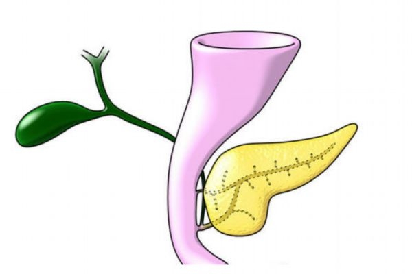 什么是胰腺癌呢 胰腺癌有什么危害呢 什么是胰腺癌呢 胰腺癌有什么危害呢