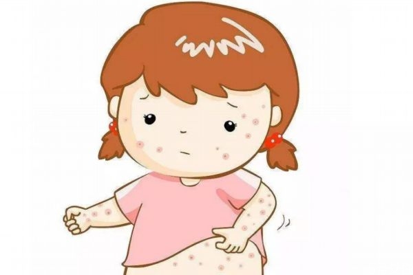 痱子是怎么造成的呢 為什么會(huì)有痱子呢 痱子是怎么造成的呢 為什么會(huì)有痱子呢