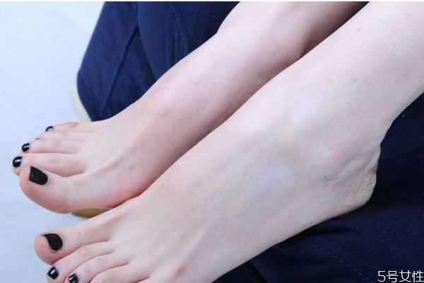 為什么女生腳會非常大呢 造成女生腳大的原因有什么呢 為什么女生腳會非常大呢 造成女生腳大的原因有什么呢