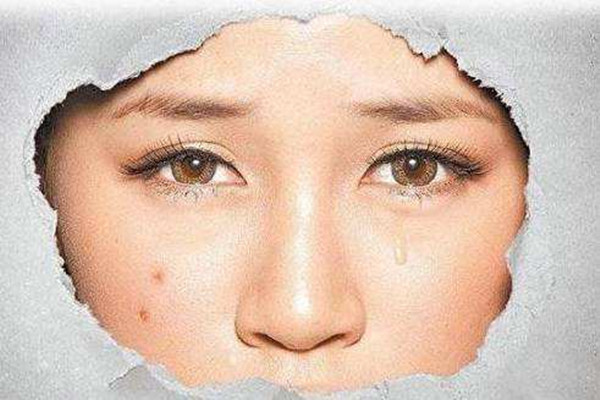 痘印消失的時間跟膚色有關(guān)嗎 痘印要多久能消除