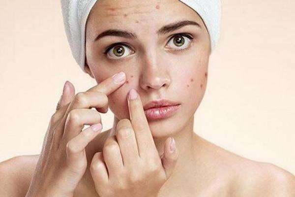 痘印消失的時間跟膚色有關(guān)嗎 痘印要多久能消除