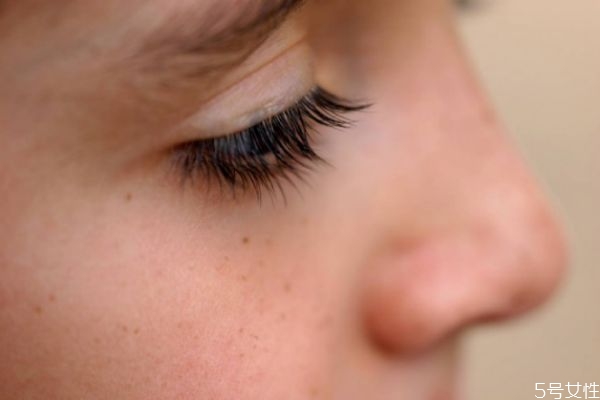 鼻子上有皺紋怎么去除 鼻子上有細(xì)紋什么原因 鼻子上有皺紋怎么去除 鼻子上有細(xì)紋什么原因