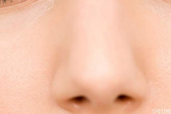 鼻子上有皺紋怎么去除 鼻子上有細(xì)紋什么原因 鼻子上有皺紋怎么去除 鼻子上有細(xì)紋什么原因