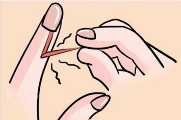 拔倒刺手腫了怎么辦 倒刺怎么處理不會腫 拔倒刺手腫了怎么辦 倒刺怎么處理不會腫