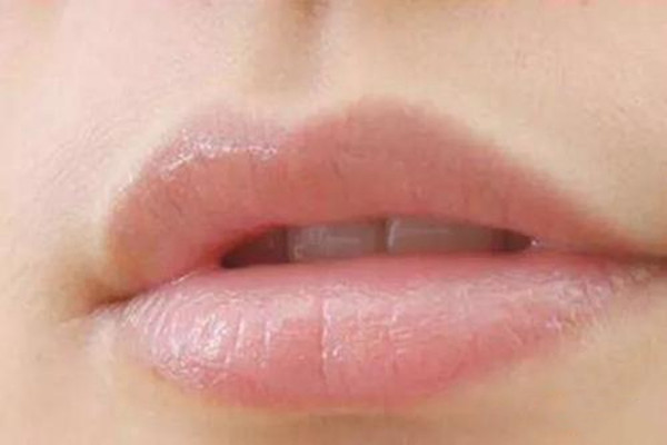 女生長小胡子的原因 女生長小胡子是雄激素偏高嗎 女生長小胡子的原因 女生長小胡子是雄激素偏高嗎