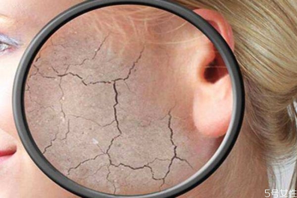 皮膚干燥起皮吃點什么最好 皮膚干燥起皮怎么辦 皮膚干燥起皮吃點什么最好 皮膚干燥起皮怎么辦