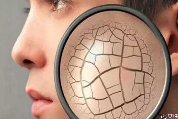 皮膚干燥起皮吃點什么最好 皮膚干燥起皮怎么辦 皮膚干燥起皮吃點什么最好 皮膚干燥起皮怎么辦