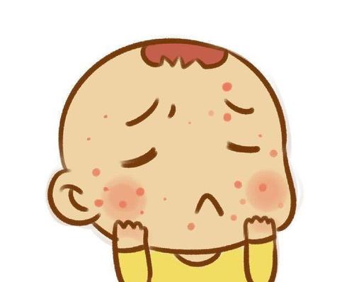 濕疹飲食要注意什么 濕疹不能吃什么 濕疹飲食要注意什么 濕疹不能吃什么