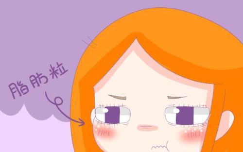 脂肪粒會(huì)越長(zhǎng)越多嗎 脂肪粒可以用針挑嗎
