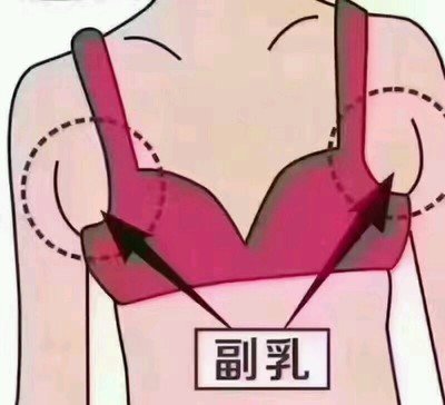 什么是副乳 怎么判斷自己有沒有副乳 什么是副乳 怎么判斷自己有沒有副乳