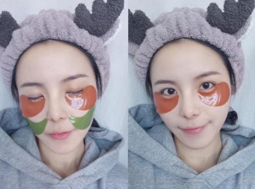 眼瞼水腫的原因 眼瞼水腫怎么辦 眼瞼水腫的原因 眼瞼水腫怎么辦