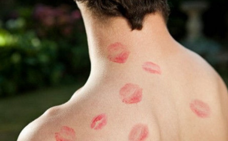 吻痕是熱敷還是冷敷 吻痕多久會消失 吻痕是熱敷還是冷敷 吻痕多久會消失